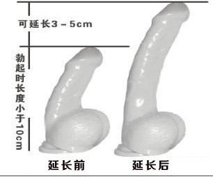 阴经延长术